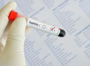 Syphilis latente ou latente: symptômes, diagnostic, traitement